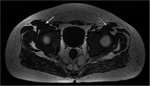 https://cdn.ncbi.nlm.nih.gov/pmc/blobs/5933/7718709/d3f223739ca3/12887_2020_2420_Fig4_HTML.jpg