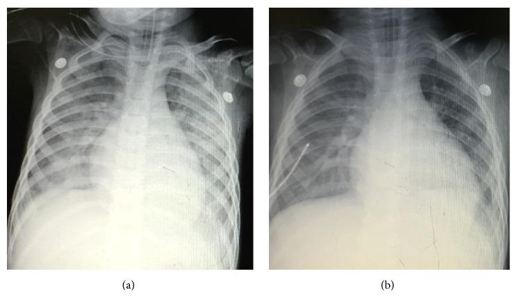 https://cdn.ncbi.nlm.nih.gov/pmc/blobs/5939/6016228/92d15789b34b/BMRI2018-4687346.003.jpg