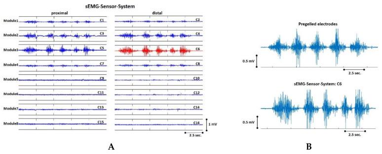 https://cdn.ncbi.nlm.nih.gov/pmc/blobs/5939/7767446/a836c2e3ec01/sensors-20-07348-g005.jpg