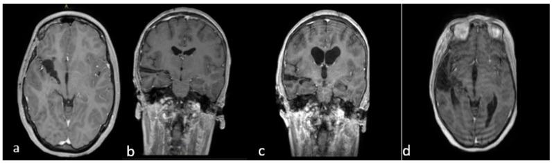 https://cdn.ncbi.nlm.nih.gov/pmc/blobs/5940/10488778/cf7a0fe6c6b6/jcm-12-05521-g005.jpg