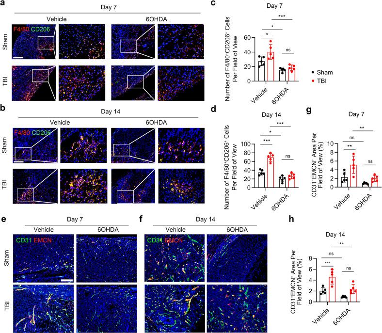 https://cdn.ncbi.nlm.nih.gov/pmc/blobs/5943/10319807/5f7584ce5cb7/41392_2023_1457_Fig3_HTML.jpg