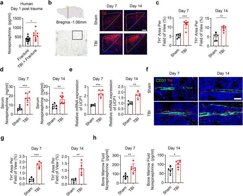 https://cdn.ncbi.nlm.nih.gov/pmc/blobs/5943/10319807/62977e48d6cc/41392_2023_1457_Fig1_HTML.jpg