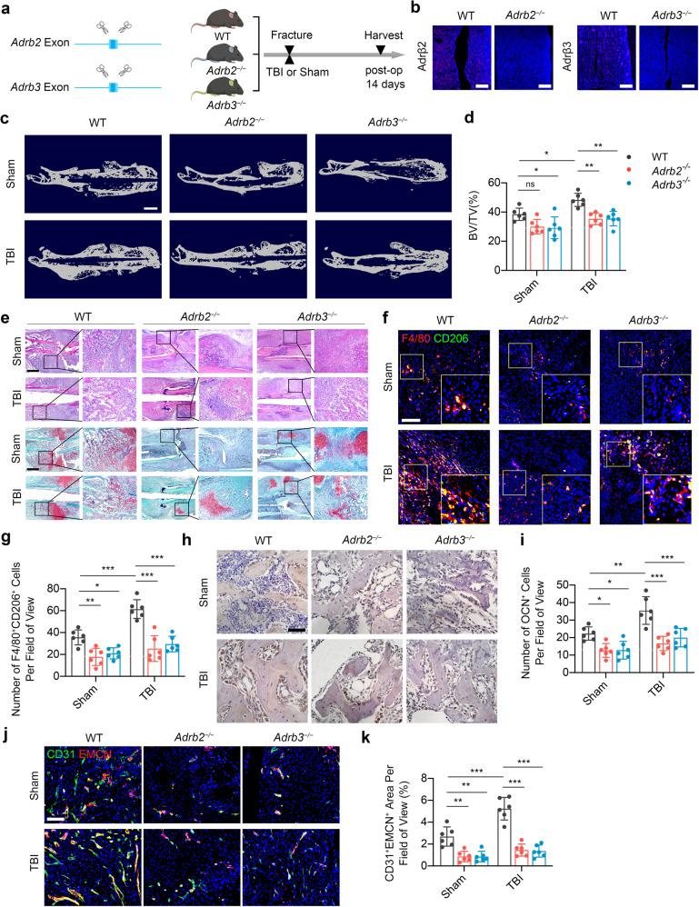https://cdn.ncbi.nlm.nih.gov/pmc/blobs/5943/10319807/dda357bae030/41392_2023_1457_Fig6_HTML.jpg