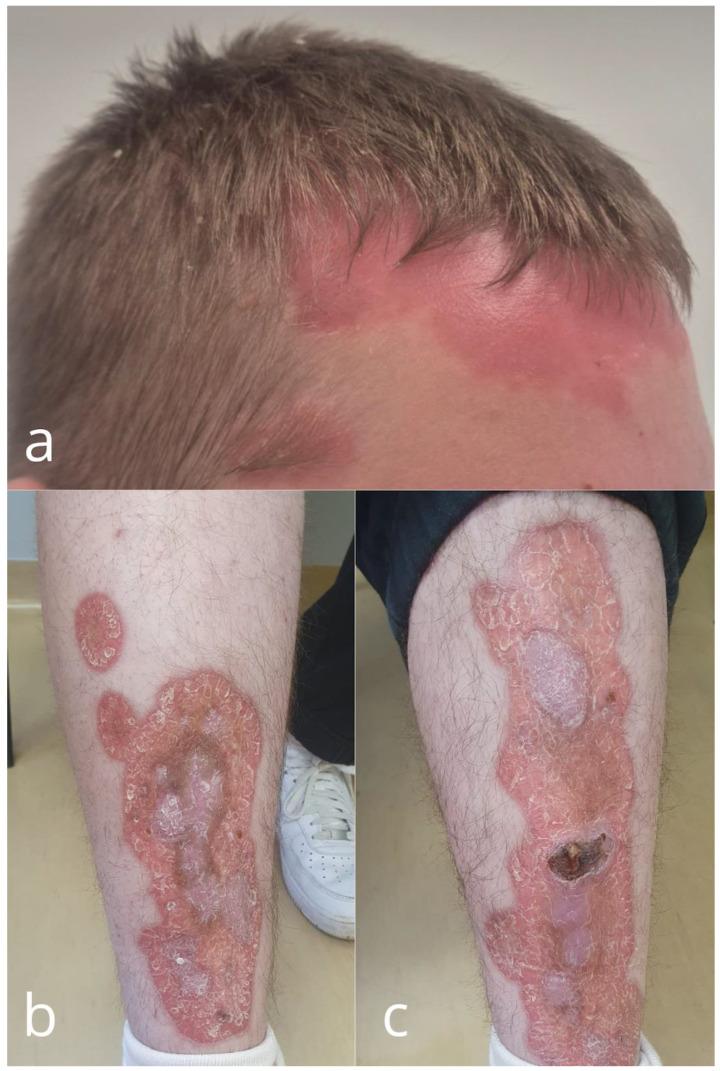 https://cdn.ncbi.nlm.nih.gov/pmc/blobs/5943/12026325/8ea2afea7f8c/cells-14-00610-g001.jpg