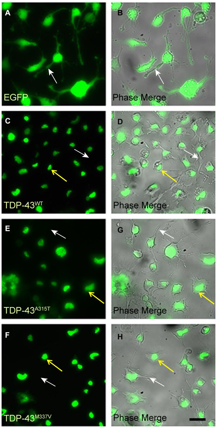 https://cdn.ncbi.nlm.nih.gov/pmc/blobs/5946/8217991/2a401131ec76/fcell-09-611601-g002.jpg
