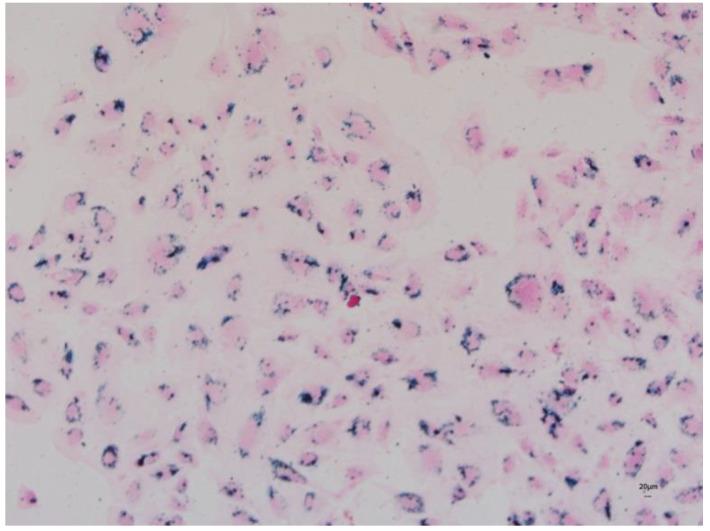 https://cdn.ncbi.nlm.nih.gov/pmc/blobs/594c/10054380/9272cee3eeb0/jcm-12-02395-g006.jpg