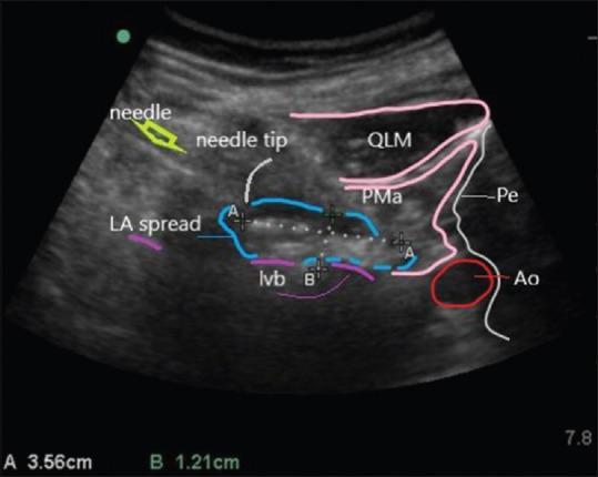 https://cdn.ncbi.nlm.nih.gov/pmc/blobs/594e/8944356/5f7d0baa3e73/JOACP-37-565-g003.jpg