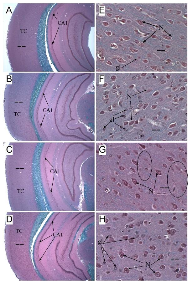 https://cdn.ncbi.nlm.nih.gov/pmc/blobs/5954/2803782/2082f7b315a0/1750-1326-4-54-4.jpg