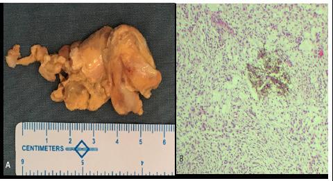 https://cdn.ncbi.nlm.nih.gov/pmc/blobs/5957/11930292/79d6956234e0/JNMA-63-282-114-g3.jpg
