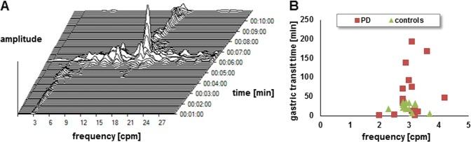 https://cdn.ncbi.nlm.nih.gov/pmc/blobs/5957/6659650/eaceb206b1ca/41531_2019_87_Fig2_HTML.jpg