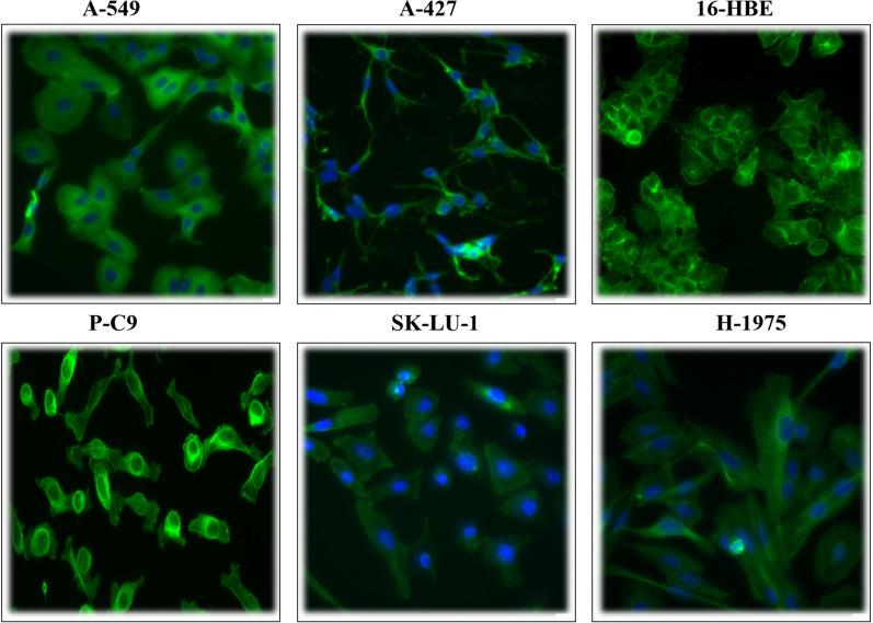 https://cdn.ncbi.nlm.nih.gov/pmc/blobs/5957/8105370/03223ca7202f/41598_2021_89352_Fig2_HTML.jpg