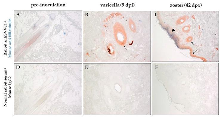 https://cdn.ncbi.nlm.nih.gov/pmc/blobs/5959/9227806/7e66c132d5f5/viruses-14-01167-g003.jpg