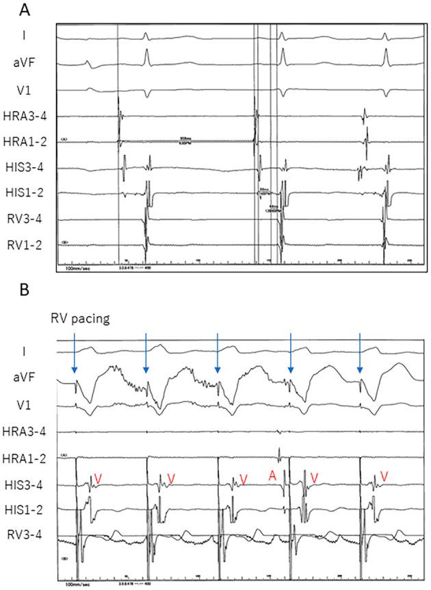 https://cdn.ncbi.nlm.nih.gov/pmc/blobs/5967/6395142/853e6450648f/1349-7235-58-0401-g003.jpg