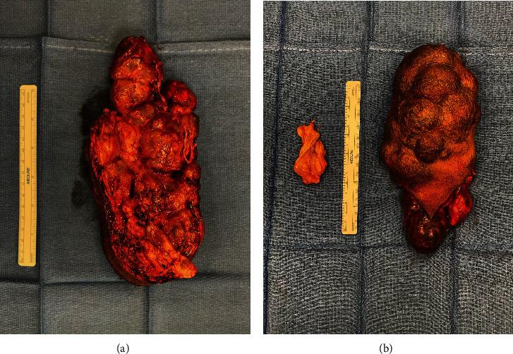 https://cdn.ncbi.nlm.nih.gov/pmc/blobs/596f/11068446/86745e602b23/CRIONM2024-6645278.002.jpg