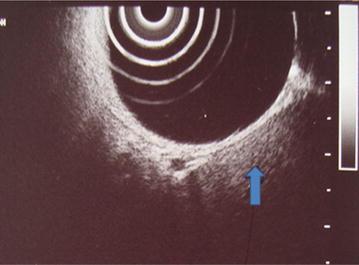 https://cdn.ncbi.nlm.nih.gov/pmc/blobs/596f/4804510/876cd7dae64d/13104_2016_1995_Fig2_HTML.jpg
