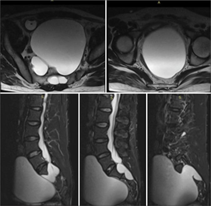 https://cdn.ncbi.nlm.nih.gov/pmc/blobs/5974/10070324/afe9a8c7028e/SNI-14-95-g002.jpg