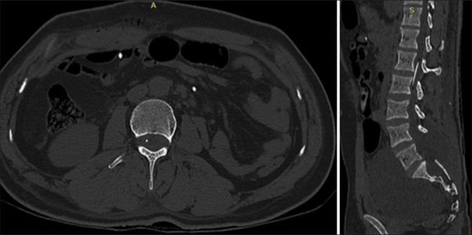https://cdn.ncbi.nlm.nih.gov/pmc/blobs/5974/10070324/fc456e3dd926/SNI-14-95-g004.jpg