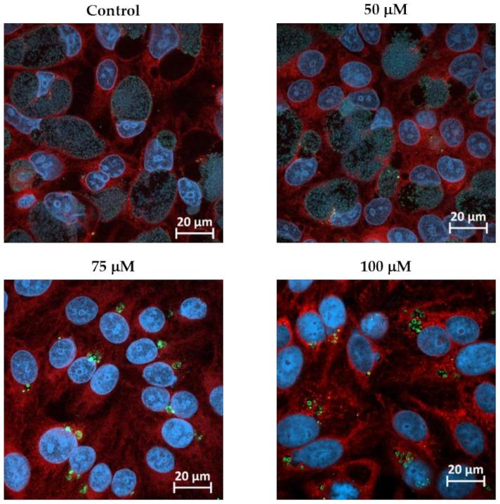https://cdn.ncbi.nlm.nih.gov/pmc/blobs/597c/7760296/a2ee4051f8cd/microorganisms-08-01848-g001.jpg