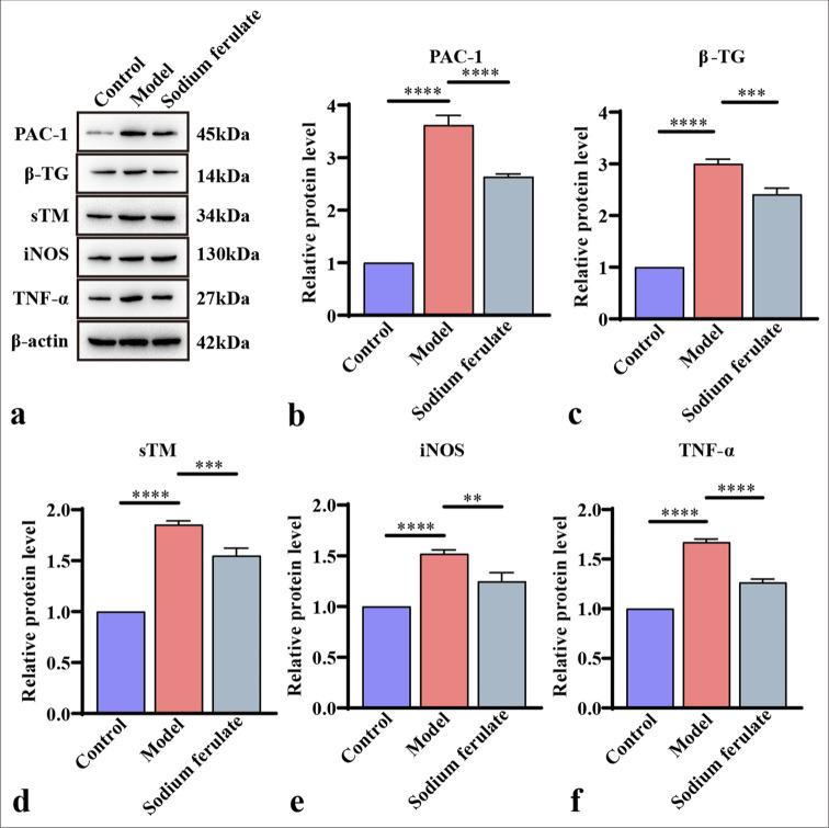 https://cdn.ncbi.nlm.nih.gov/pmc/blobs/597d/11801691/b3376328fbb9/Cytojournal-21-76-g004.jpg