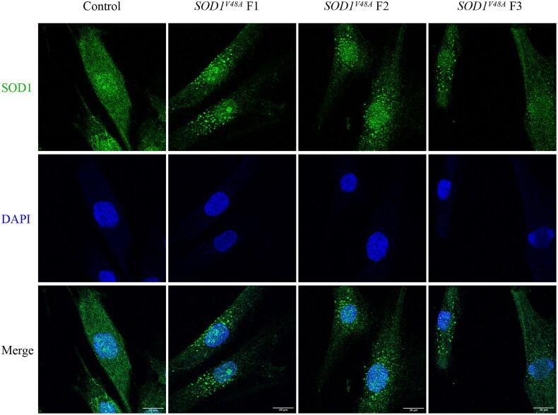 https://cdn.ncbi.nlm.nih.gov/pmc/blobs/5980/11445911/9b529a2aa325/IANN_A_2407522_F0002_C.jpg