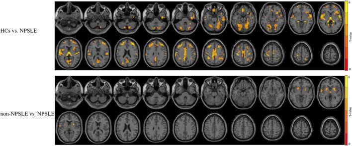 https://cdn.ncbi.nlm.nih.gov/pmc/blobs/5983/9108669/6d57f223962e/fnins-16-839194-g001.jpg