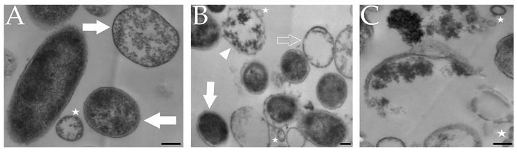 https://cdn.ncbi.nlm.nih.gov/pmc/blobs/598e/7157236/f1bfd736b6d7/pathogens-09-00184-g007.jpg