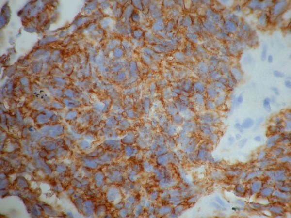 https://cdn.ncbi.nlm.nih.gov/pmc/blobs/598f/3018402/4042ff0aa557/1752-1947-4-408-5.jpg