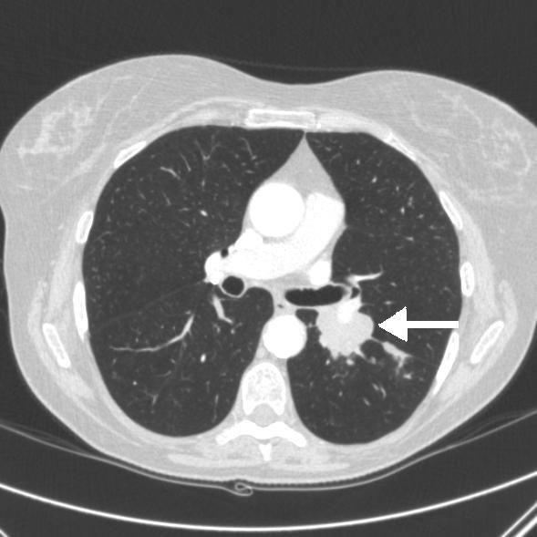 https://cdn.ncbi.nlm.nih.gov/pmc/blobs/598f/3018402/722246aaafe3/1752-1947-4-408-2.jpg