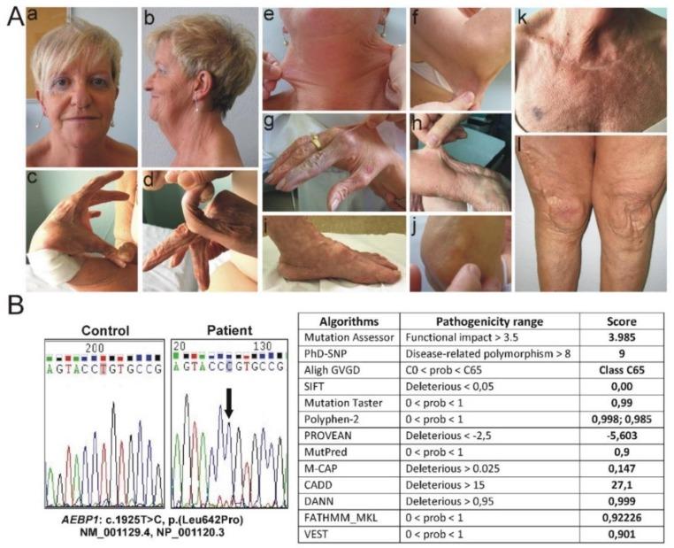 https://cdn.ncbi.nlm.nih.gov/pmc/blobs/598f/6410021/d4c66b23343e/genes-10-00135-g001.jpg