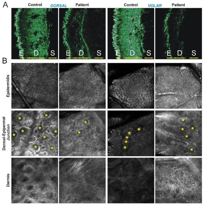 https://cdn.ncbi.nlm.nih.gov/pmc/blobs/598f/6410021/e449f473292c/genes-10-00135-g002.jpg