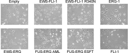 https://cdn.ncbi.nlm.nih.gov/pmc/blobs/5992/2481291/2c0e9ba25ee7/pone.0002634.g002.jpg