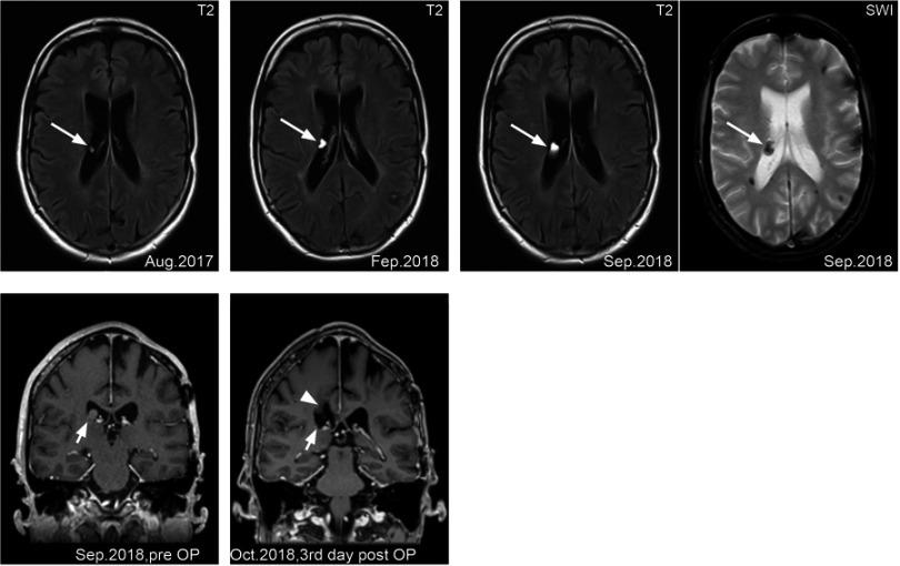 https://cdn.ncbi.nlm.nih.gov/pmc/blobs/5994/6689546/4e10854a428a/IMCRJ-12-249-g0001.jpg