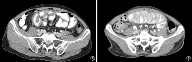 https://cdn.ncbi.nlm.nih.gov/pmc/blobs/5995/12215329/d05e93c130d7/ac-2024-00486-0069f6.jpg
