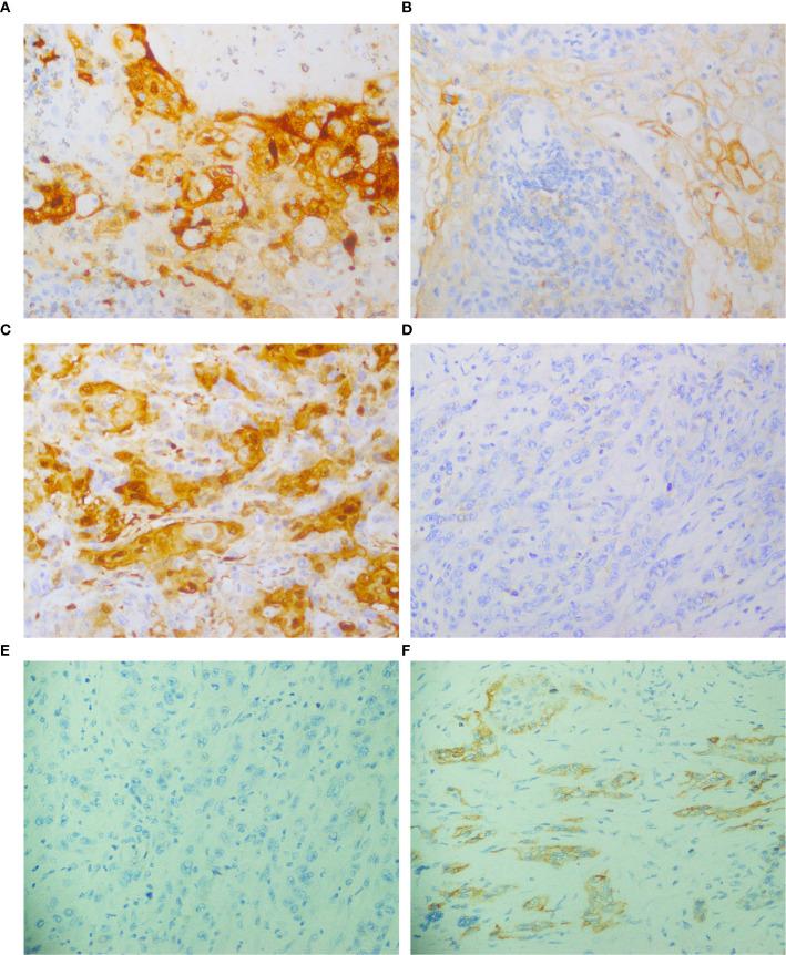 https://cdn.ncbi.nlm.nih.gov/pmc/blobs/59a9/12378751/9623e89bcaa2/fonc-15-1495722-g003.jpg