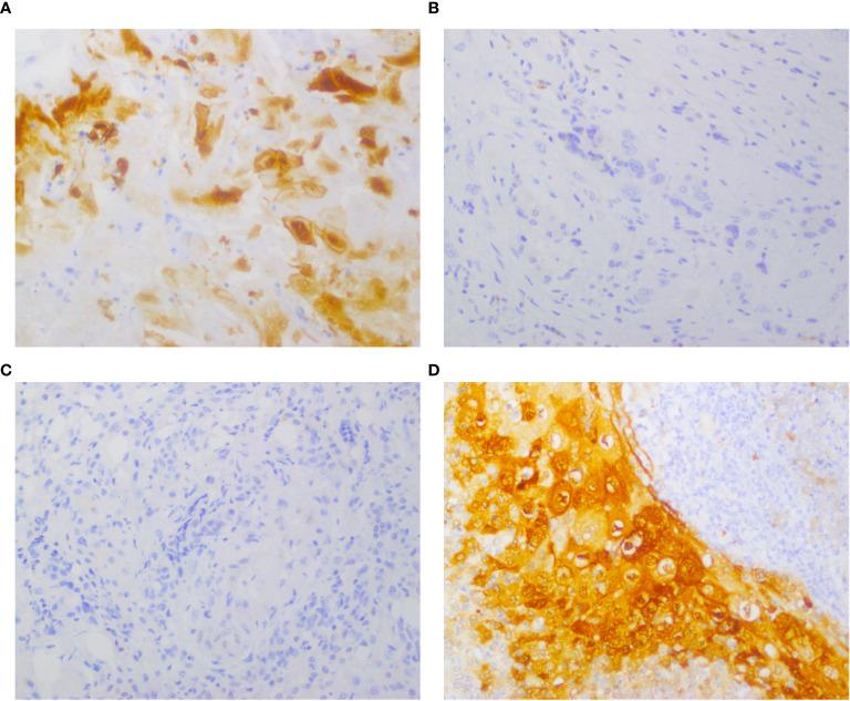 https://cdn.ncbi.nlm.nih.gov/pmc/blobs/59a9/12378751/c666894d0343/fonc-15-1495722-g001.jpg