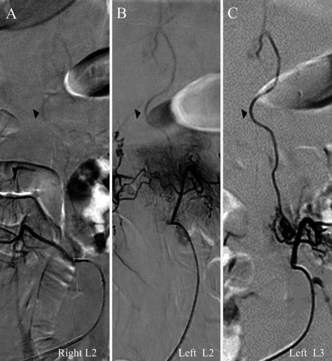 https://cdn.ncbi.nlm.nih.gov/pmc/blobs/59a9/9514287/ab0051ad341c/CASE22275f3.jpg