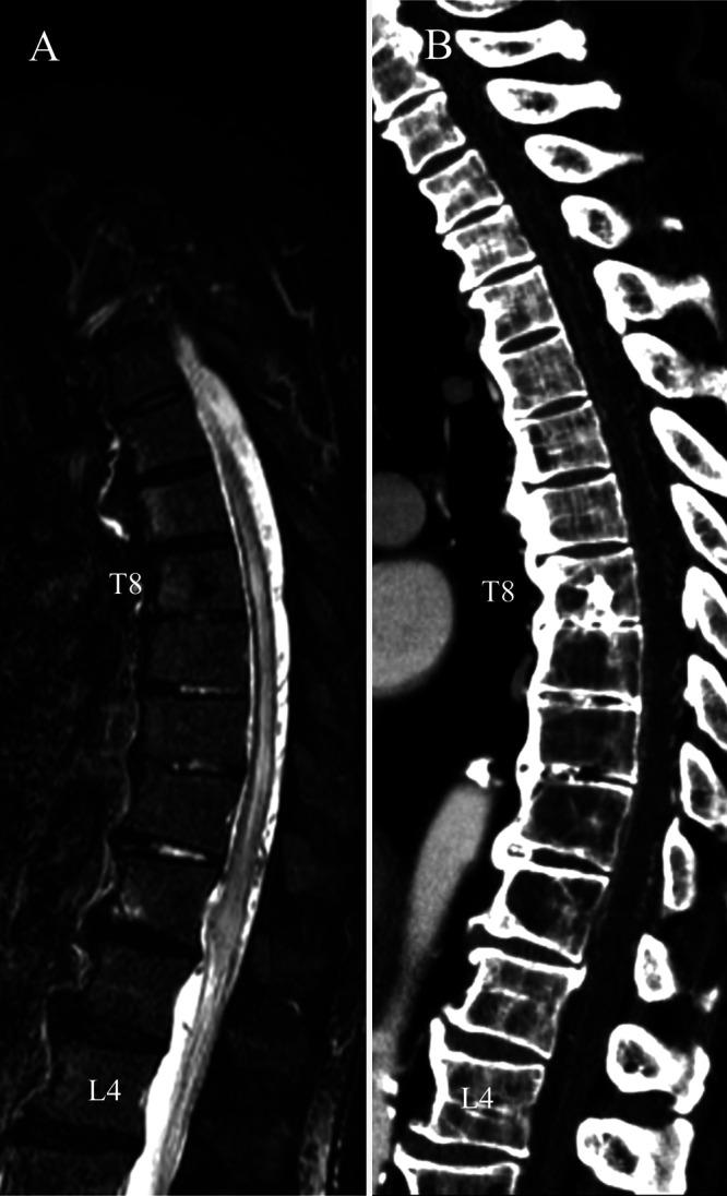 https://cdn.ncbi.nlm.nih.gov/pmc/blobs/59a9/9514287/ab9b17e00936/CASE22275f1.jpg