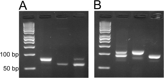 https://cdn.ncbi.nlm.nih.gov/pmc/blobs/59aa/5734763/e9db63c76b09/pone.0189680.g002.jpg
