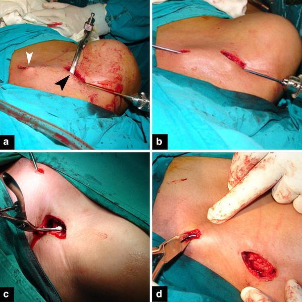 https://cdn.ncbi.nlm.nih.gov/pmc/blobs/59ac/4417844/c7d8ac5c2469/10195_2011_158_Fig2_HTML.jpg