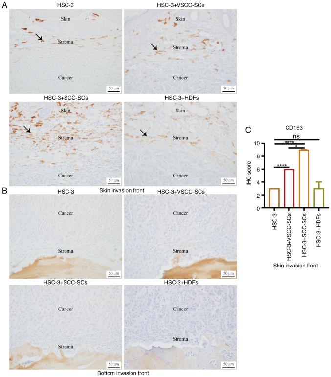 https://cdn.ncbi.nlm.nih.gov/pmc/blobs/59b0/9097767/13e03395e7e5/IJO-60-06-05368-g06.jpg