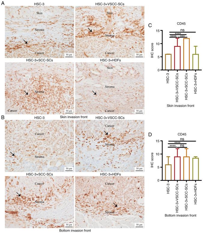 https://cdn.ncbi.nlm.nih.gov/pmc/blobs/59b0/9097767/6d5bb975bc10/IJO-60-06-05368-g04.jpg