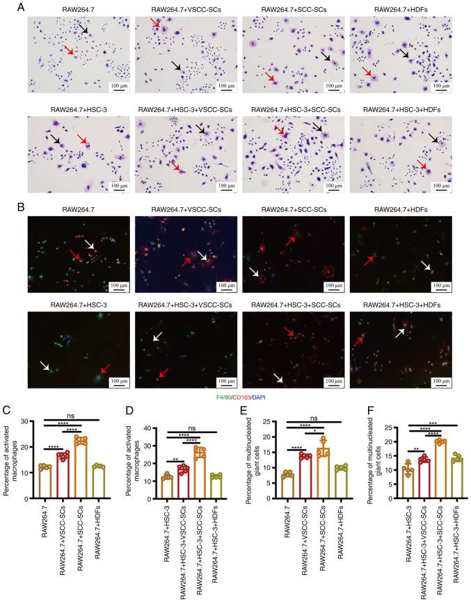 https://cdn.ncbi.nlm.nih.gov/pmc/blobs/59b0/9097767/b2859f1aafbc/IJO-60-06-05368-g00.jpg
