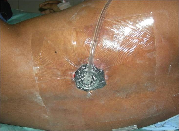 https://cdn.ncbi.nlm.nih.gov/pmc/blobs/59b3/3495384/1c3b2b381fa2/IJPS-45-332-g014.jpg