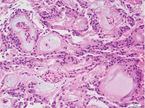 https://cdn.ncbi.nlm.nih.gov/pmc/blobs/59b4/4083675/28b802487567/rt-2014-2-5404-g002.jpg