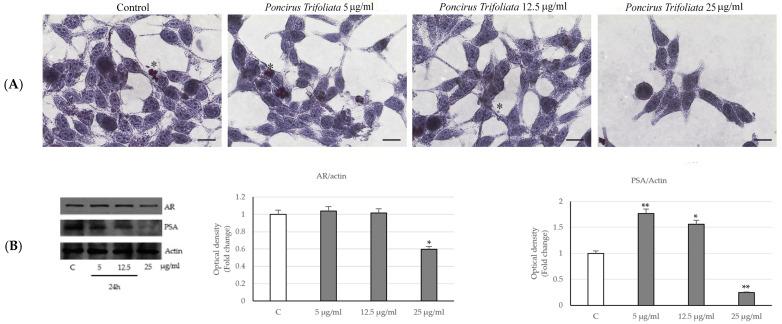 https://cdn.ncbi.nlm.nih.gov/pmc/blobs/59b8/10671002/4ad685c8abab/ijms-24-16351-g003.jpg