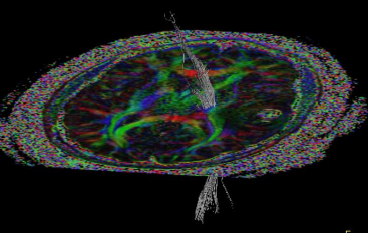 https://cdn.ncbi.nlm.nih.gov/pmc/blobs/59bd/12182469/0f321d572799/701_2025_6593_Fig4_HTML.jpg