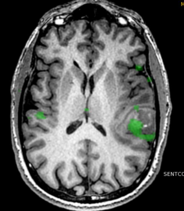 https://cdn.ncbi.nlm.nih.gov/pmc/blobs/59bd/12182469/5695fa5c677d/701_2025_6593_Fig3_HTML.jpg