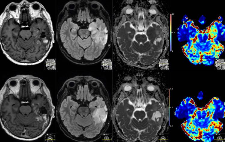 https://cdn.ncbi.nlm.nih.gov/pmc/blobs/59bd/12182469/79a4883abcf0/701_2025_6593_Fig5_HTML.jpg