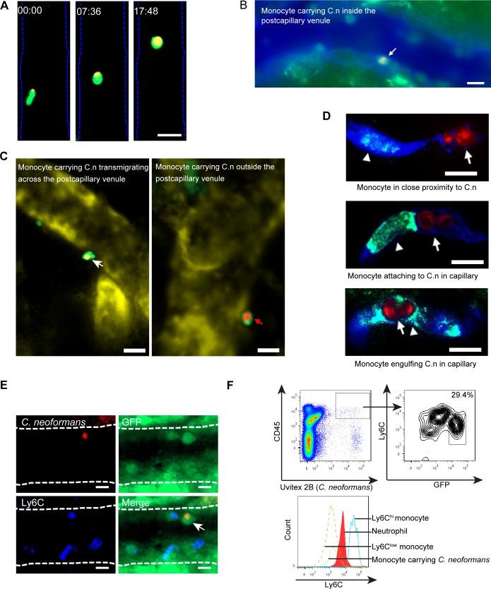https://cdn.ncbi.nlm.nih.gov/pmc/blobs/59bd/7062284/795e11fe5bde/ppat.1008361.g006.jpg