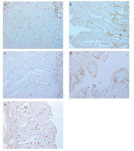 https://cdn.ncbi.nlm.nih.gov/pmc/blobs/59c5/3167290/86a1388e4cb2/ejh-2010-1-e4-g001.jpg